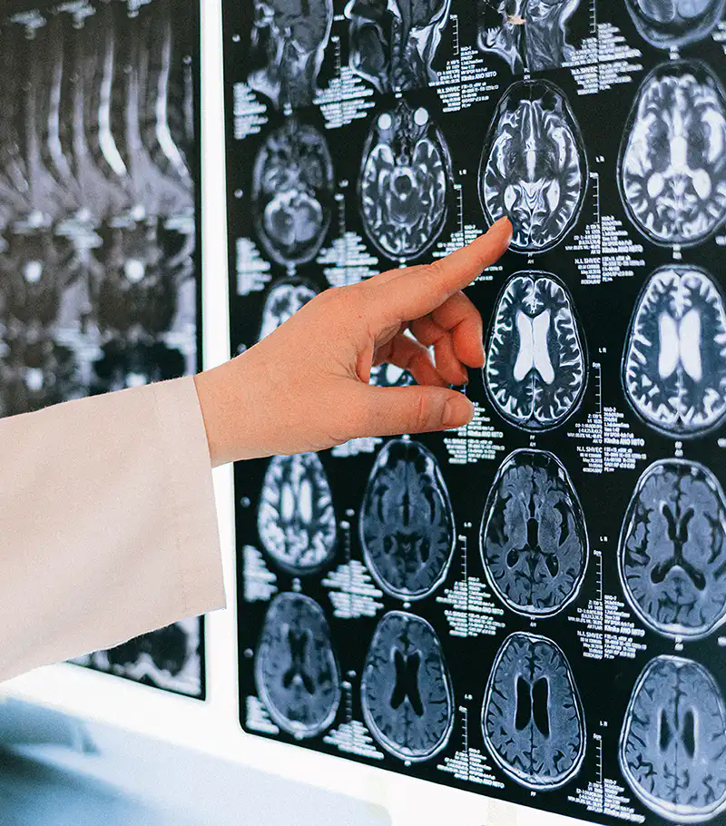 人類大腦是如何進化的?